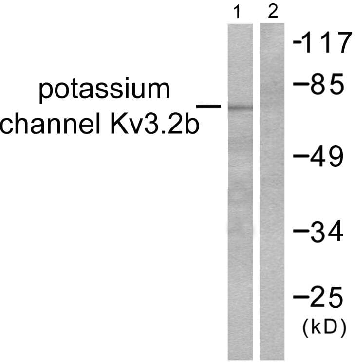 KCNC2 / Kv3.2 Antibody