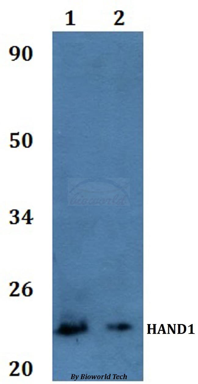 Polyclonal Rabbit anti-Human HAND1 Antibody (WB)