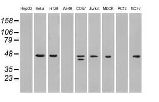 Monoclonal Mouse anti-Human SSB / La Antibody (clone OTI3F11, IHC, IF, WB)