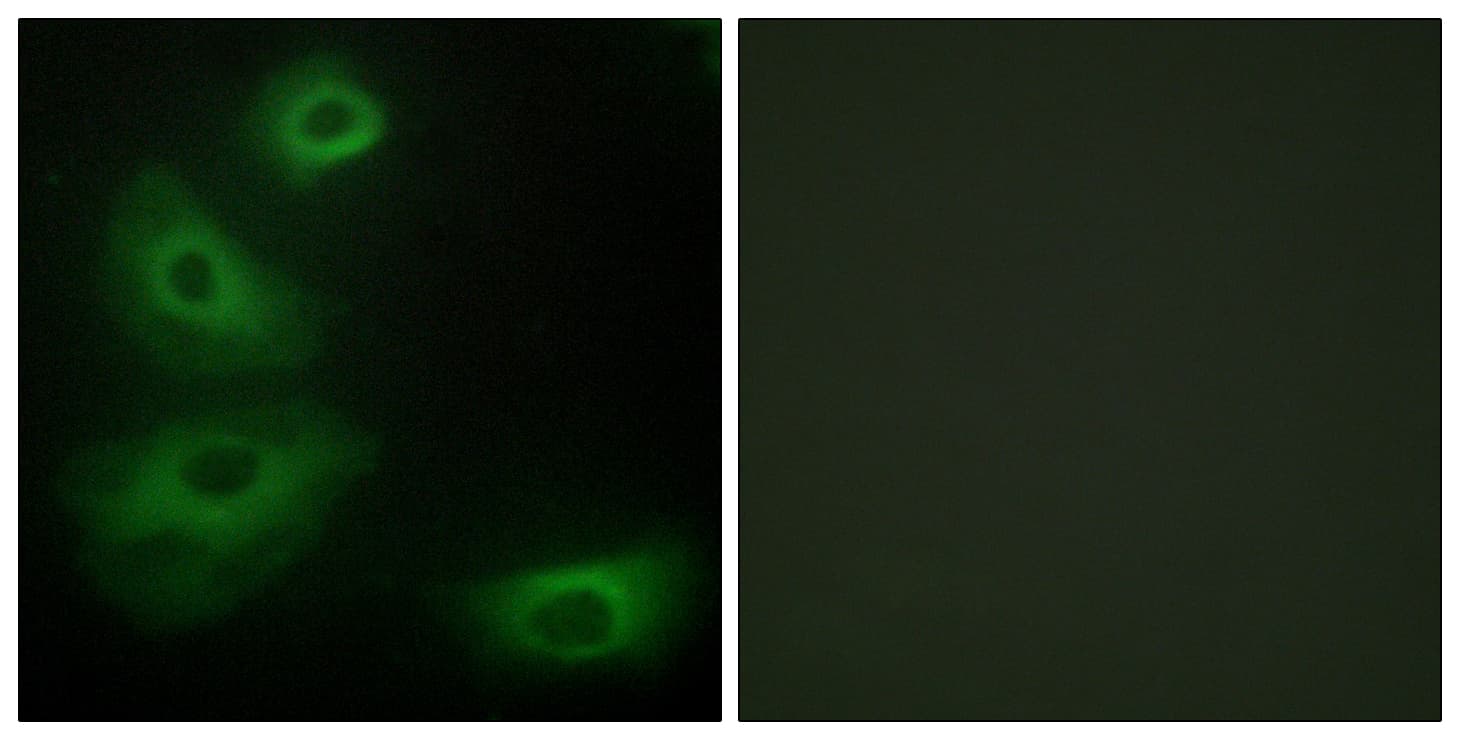 HTR1B / 5-HT1B Receptor Antibody (aa201-250)