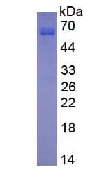 Rat MMP13 Protein (Recombinant His, N-Terminal)