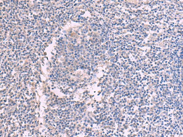 CCT5 / TCP1 Epsilon Antibody