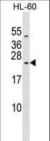 RPL10L Antibody (aa9-35)