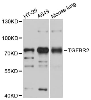 TGFBR2 Antibody