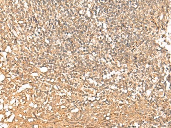 IEF-SSP-9502 / PWP1 Antibody