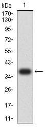 SSTR2 Antibody (clone 6H9D2)