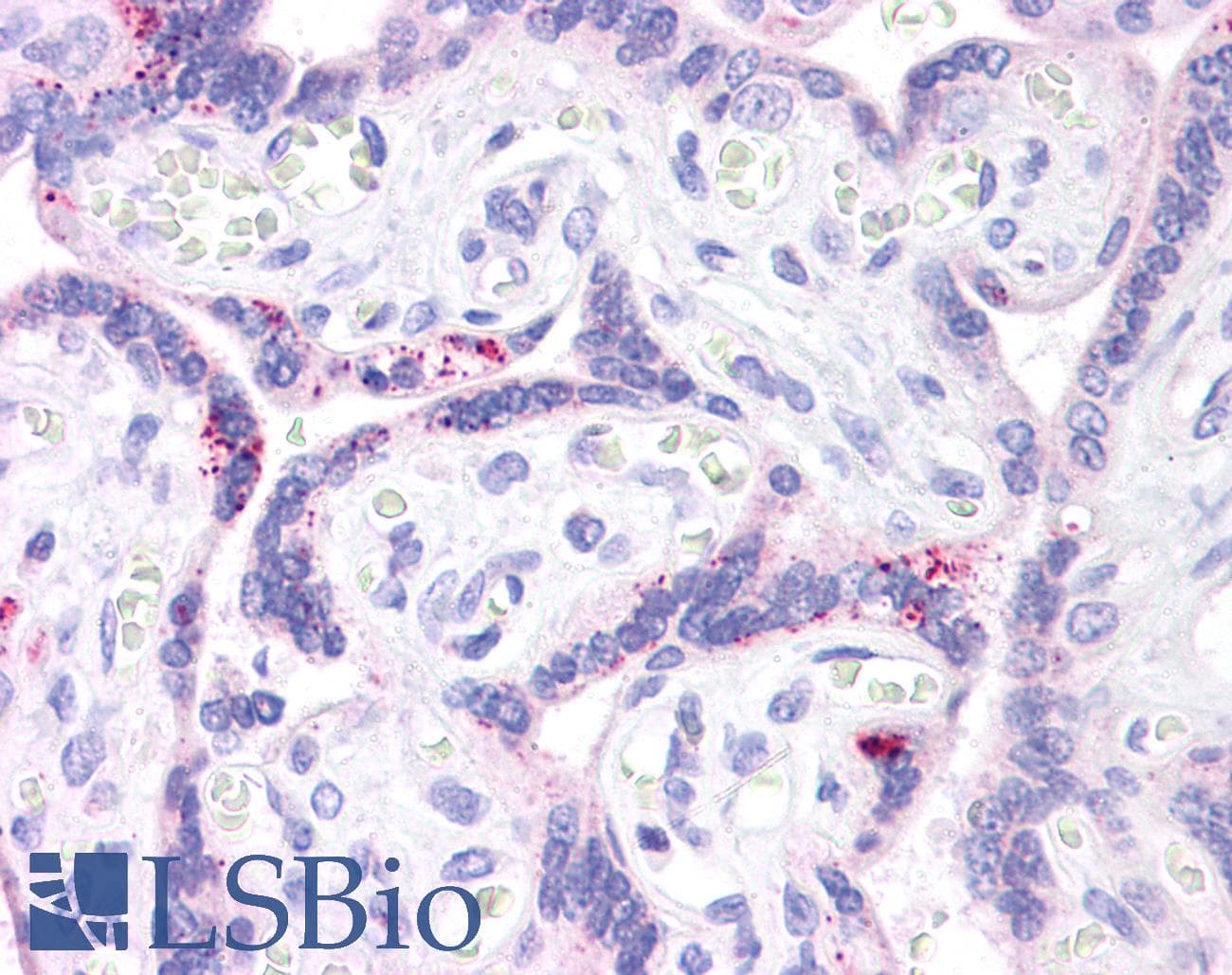 ABCB1 / MDR1 / P Glycoprotein Antibody (aa863-912)