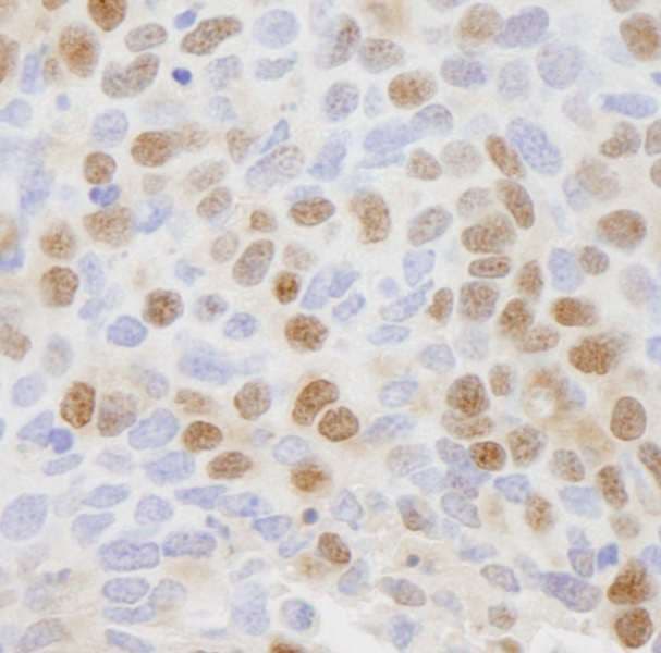 CSE1L Antibody (aa1-50)