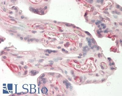 ANGPTL3 Antibody (aa71-120)