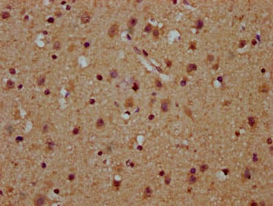 USB1 Antibody