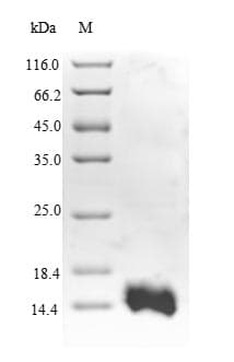 Human RGS5 Protein (Recombinant GST, N-terminus)