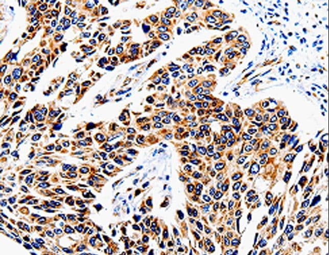 Polyclonal Rabbit anti-Human COX16 / C14orf112 Antibody (IHC)