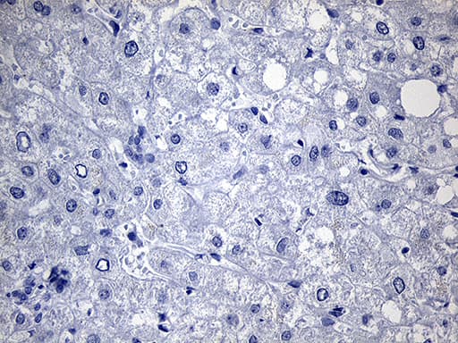 TG / Thyroglobulin Antibody (aa20-358, clone OTI2B9)
