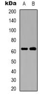 Polyclonal Rabbit anti-Human SLC1A2 / EAAT2 / GLT-1 Antibody (WB)