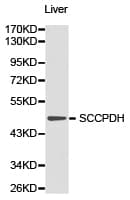 SCCPDH Antibody