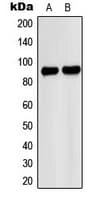 Polyclonal Rabbit anti-Human PNPLA8 Antibody (C-Terminus, WB)