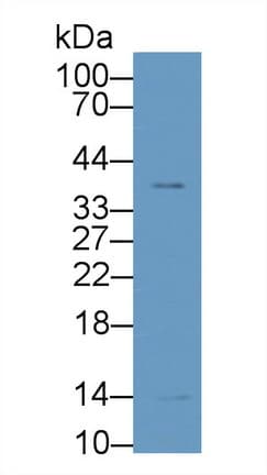 LGALS1 / Galectin 1 Antibody (aa2-135, APC)