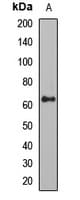 SQSTM1 Antibody