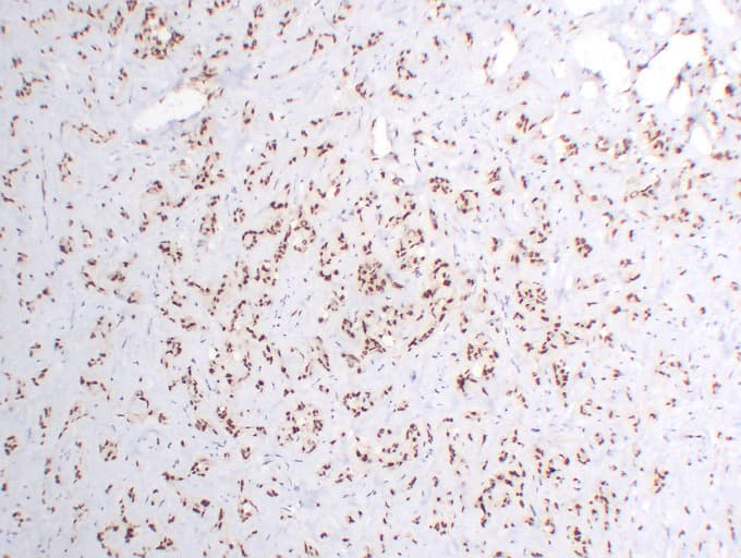 Monoclonal Mouse anti-Human FLI1 Antibody (clone ABT-FLI1, IHC, WB)