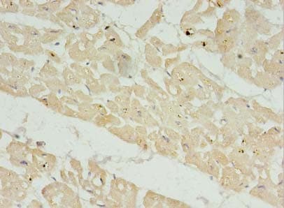 FAM156A / TMEM29 Antibody