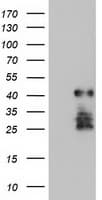 SSX5 Antibody (clone OTI1H1)