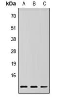 Polyclonal Rabbit anti-Human RPLP2 Antibody (Internal, IHC, WB)