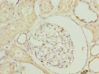 SLA Antibody