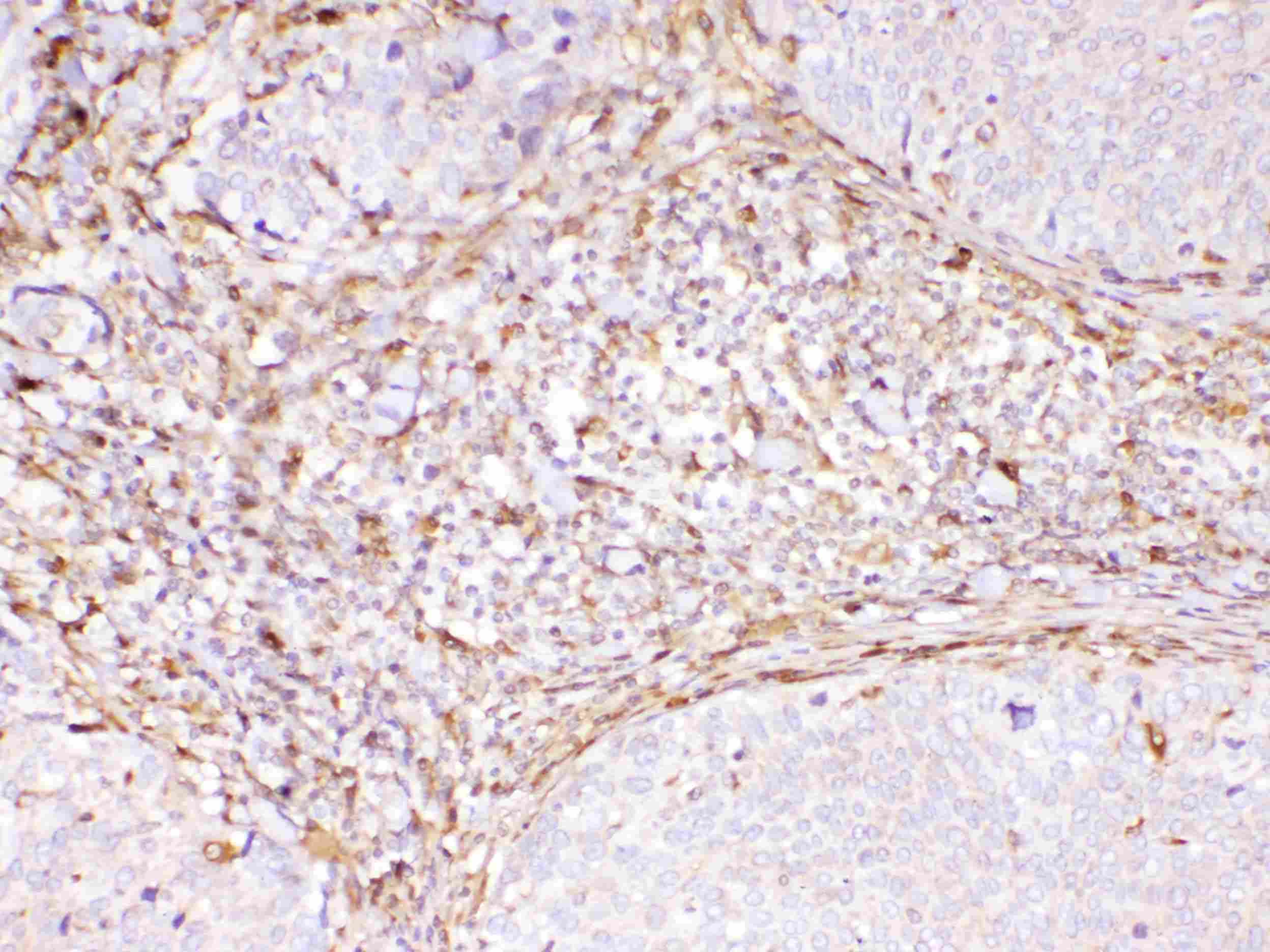 Polyclonal Rabbit anti-Human PPIB / Cyclophilin B Antibody (IHC, WB)