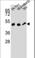 ZFP30 Antibody (aa65-94)