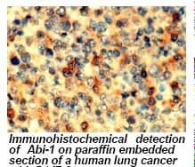 ABI1 / SSH3BP1 Antibody (clone 1B9)