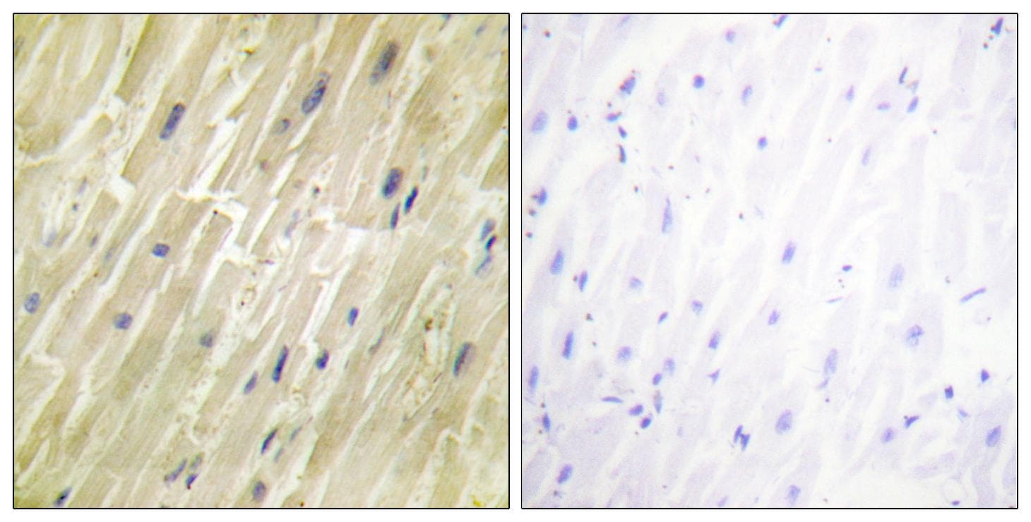 CKM / Creatine Kinase MM Antibody