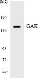Polyclonal Rabbit anti-Human GAK Antibody (aa80-129, WB)