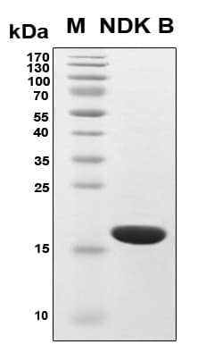 Human NME2 Protein (Recombinant 6His, N-terminus)
