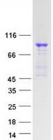 Human TBX3 Protein (Recombinant Myc-DDK (Flag))