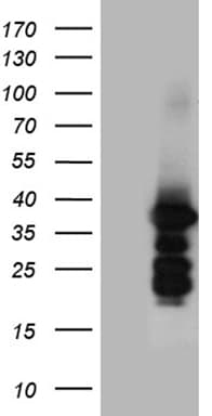 ZCCHC17 / PNO40 / PS1D Antibody (clone OTI7F9)