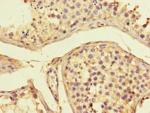 ADORA2A/Adenosine A2A Receptor Antibody