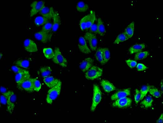 SLAMF1 / SLAM / CD150 Antibody
