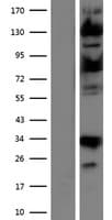 USP15 Protein (Over-Expression Lysate Myc-DDK (Flag))