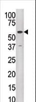 KAT5 / TIP60 Antibody (aa467-498)