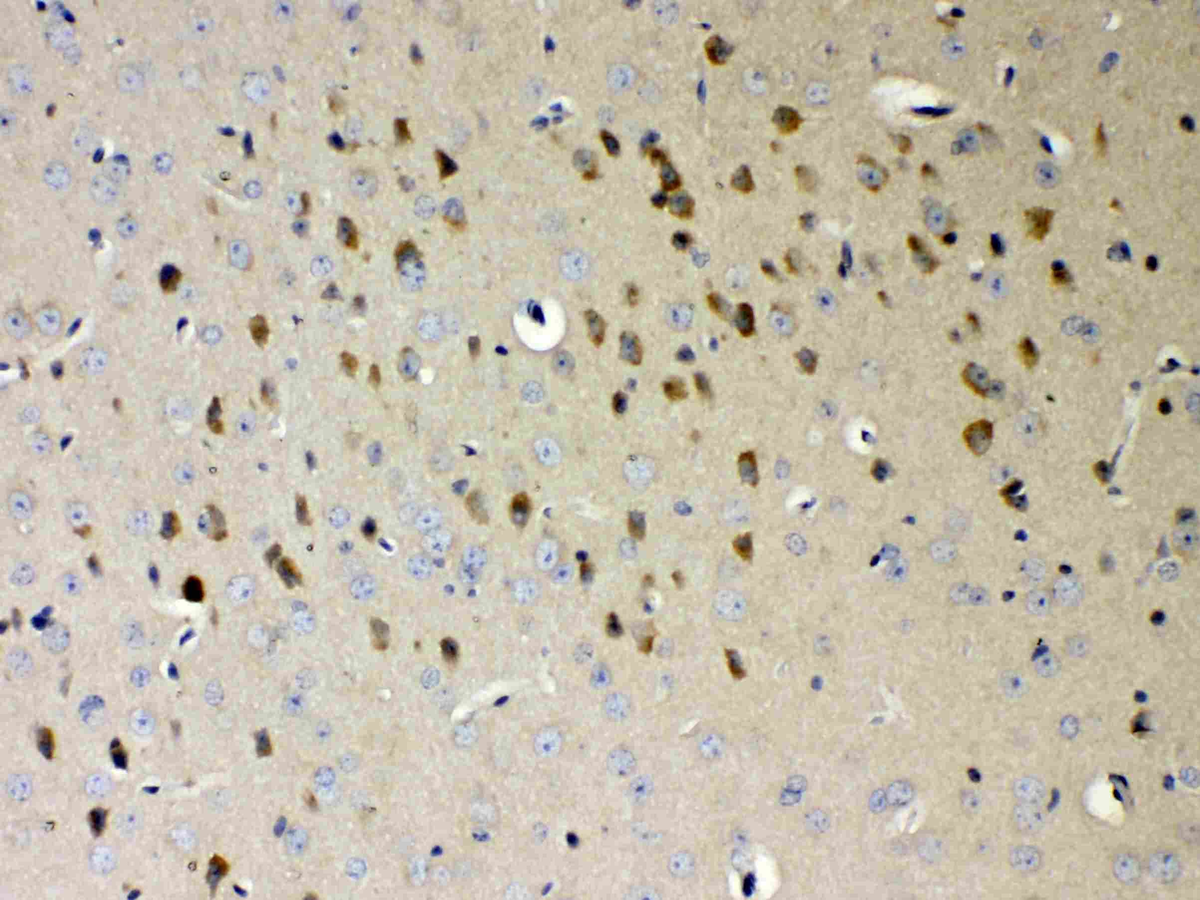 Polyclonal Rabbit anti-Human PAPD7 / TRF4-1 Antibody (IHC, WB)