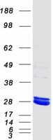Human MMAB Protein (Recombinant Myc-DDK (Flag))