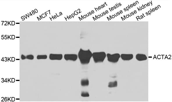 IHC-plus™ Polyclonal Rabbit anti-Human ACTA2 / Smooth Muscle Actin Antibody (IHC, WB)