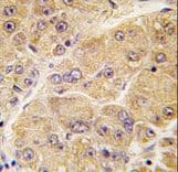 Polyclonal Rabbit anti-Human SOST / Sclerostin Antibody (aa134-163, IHC, WB)