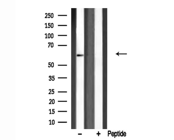 PRKCSH Antibody
