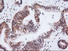 ERCC4 / XPF Antibody (clone OTI4E11)