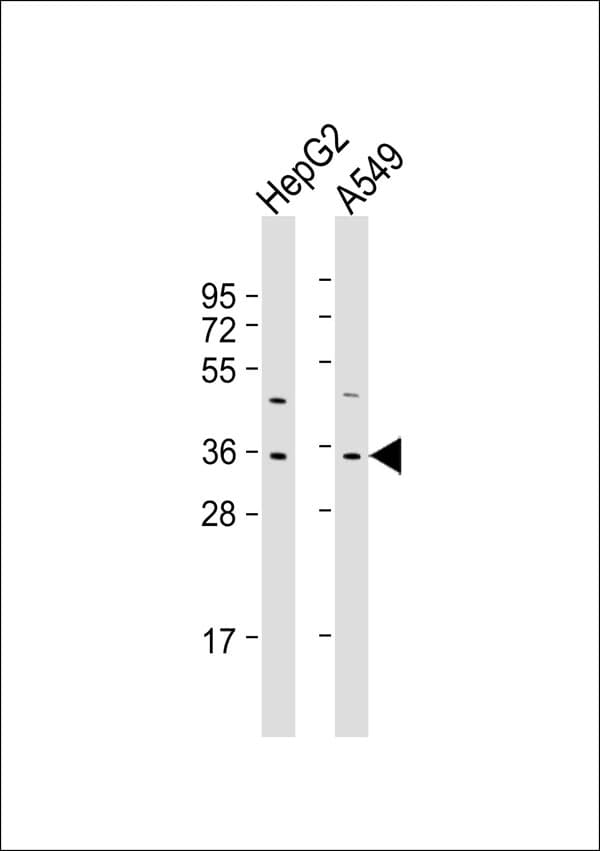 FOXE3 Antibody