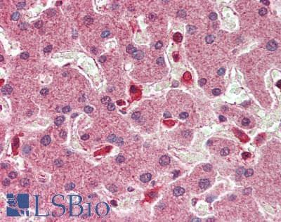 IHC-plus™ HNF1A / HNF1 Antibody (aa50-100)