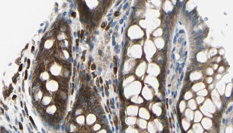 TMOD2 / Tropomodulin 2 Antibody