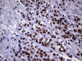 NBN / Nibrin Antibody (clone OTI7D5)