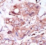 Polyclonal Rabbit anti-Human ERBB4 / HER4 Antibody (aa1276-1308, IHC, WB)